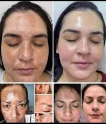 baratillo huepetuhe 🙂