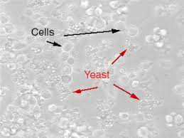 We did not find results for: Yeast Unc Lineberger