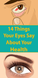 14 Things Your Eyes Say About Your Health Health Signs Eye Health Natural Health Tips