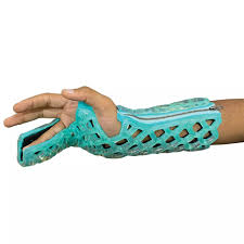 Image result for Ulnar Gutter Cast