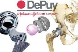 Pinnacle Hip Implant Medical Problems