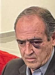 La elección interna de Canaco, motivo de la agresión a vicepresidente Gil  Cuevas