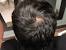 Front Thinning Hair