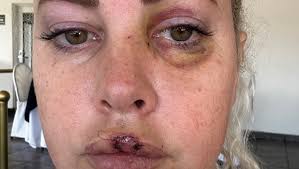 Fundraiser for Amber Joslin by Carolyn McKeown : Help for Amber, one of our  community heroes!