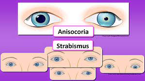 How To Assess The Eyes (Nursing)