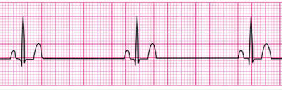 Acls Topic Wise Mcqs | Pdf | Cardiopulmonary Resuscitation | Myocardial  Infarction