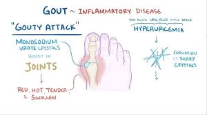 Image result for gout