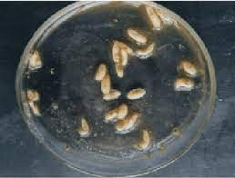 What are the most common parasitic worms found in the intestines? Small Worms Like Structures In Stool Specimen Of Patient Download Scientific Diagram