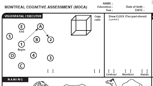 Nasreddine md 1 montreal cognitive assessment (moca) administration and scoring instructions the montreal cognitive assessment (moca) was designed as a rapid screening instrument for mild cognitive dysfunction. Montreal Cognitive Assessment What To Know Cnn