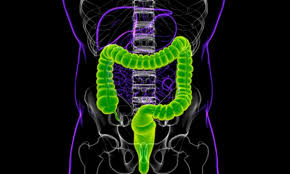 Image result for Megacolon