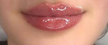 как убрать гиалуроновую кислоту из губ в домашних условиях Sposoby Ispolzovaniya Gialuronovoj Kisloty V Domashnih Usloviyah