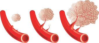 Image result for Angiogenesis