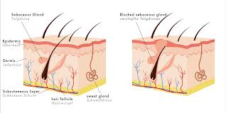 Image result for Sebaceous Gland