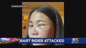 BART ATTACK: Asian woman talks with KPIX 5 about attack