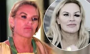 Real Housewives Of Salt Lake City: Heather Gay finally reveals who gave her  that black eye during season finale