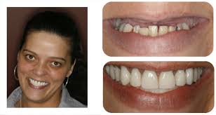 Be sure to call ahead with dr. Smile Gallery Schaefer Advanced Dentistry