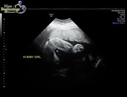 Alibaba.com offers 1,538 ultrasound baby products. Swollen Labia Ultrasound Babycenter