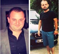 Yeme Bozukluklarinda Beslenme Beslenme Web Sitesi