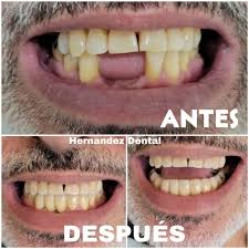 Hernández Dental Office - Dr.Eliseo Hernández