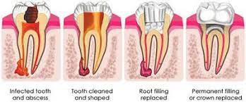 Pin On Greenvale Dental Group