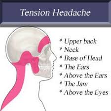 Pin On Head Pain