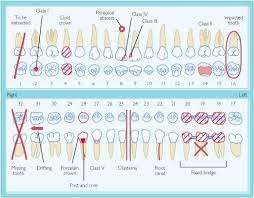 dental charting form dental humor pinterest dental