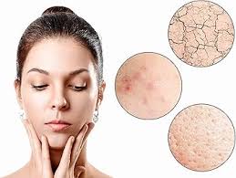 Aroma Depot 8oz Raw Kokum Butter Great for Skin, Body and Hair. 100% Pure I  Natural I Cold Pressed I Thickener for Body Butters, Sunscreens, Soaps,  Deodorants and Lotions.: Buy Online at