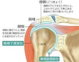 五十肩 五十肩を早く治すカギは 発症早期のリハビリ体操 名医が解説 最新治療トレンド 日経gooday グッデイ お腹を引き締めるワークアウト 健康になる 五十肩