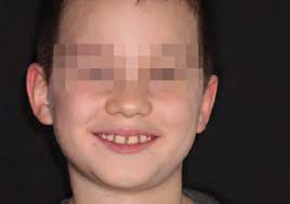 no home activation required