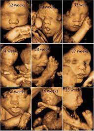Fetal Fotos 3d 4d Ultrasound Facebook