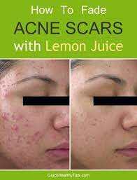 Pin On Face And Body Diy