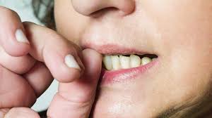 تأثیر استرس بر سلامت دهان و دندان - دکتر پیمان کنز دندانپزشک زیبایی و  ترمیمی در مهرشهر کرج