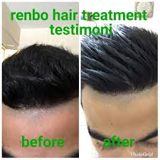 Apakah lo termasuk salah satu yang sedang mencari cara untuk meluruskan rambut? Hot Renbo Hair Straightener 3in1 Rebonding Pelurus Rambut Hair Straightening Lelaki Perempuan Kerinting Kering Shopee Malaysia