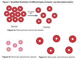 mean corpuscular hemoglobin mch and mean corpuscular