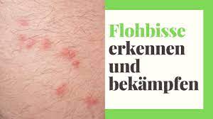 Meistens beißen flöhe füße und schienbeine. Flohbisse Flohstiche Erkennen Und Bekampfen Youtube