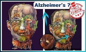 Check spelling or type a new query. Will Finding A Camel In An Image Help In Diagnosing Risk Of Alzheimer S