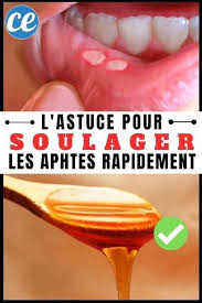 Epingle Sur Remedes Naturels