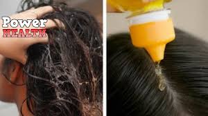 head lice naturally home remes