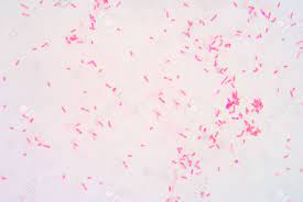 They are characterized by their cell envelopes, which are composed of a thin peptidoglycan cell wall sandwiched between an inner cytoplasmic cell membrane and a bacterial outer membrane. Gram Staining Gram Negative Bacilli Stock Photo Picture And Royalty Free Image Image 38484978