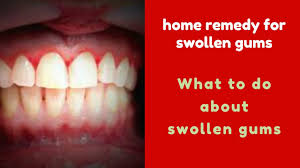 home remedy for swollen gums what to