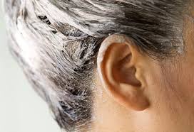 Apparently hair dye can be reactivated with more hair dye and can actually clean up unwanted hair dye on skin. 10 Tips On How To Remove Hair Dye Or Colour Stains From Skin