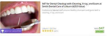 This is where we cook the cerec crowns. How To Use Groupon For Great Dental Care For Under 50 By Susan Medium