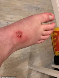 Dre has reportedly brushed off his wife's demands as ridiculous and says he is already paying her bills, including the malibu estate she lives in and security dr. Kayaker 22 Who Has Her Right Leg Amputated After An Accident In The Water Six Years Ago Daily Mail Online