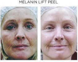 Allison Peel's Instagram, Twitter & Facebook