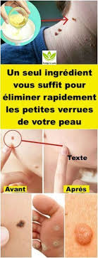 pin on projets a essayer