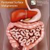 Benign mesothelioma is a tumor that isn't cancerous and doesn't spread to other parts of the body. 1