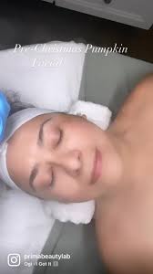 That tree won’t be the only thing glowing this month! A Pumpkin Facial  improves skin texture, hydration, and elasticity, while also creating that  Christmas glow