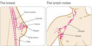 There are many types of breast cancer surgery, from taking out the area around the lump the most obvious risk factor for breast cancer is being a woman. Primary Breast Cancer Breast Cancer Now