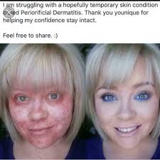 Michelle Alder (@michell37540546)