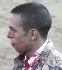 Farpas Blogue: João Ventura: "sobrevivente" da trágica corrida de Coruche  reapareceu ontem nas Caldas